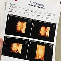 又会看的宝妈们吗