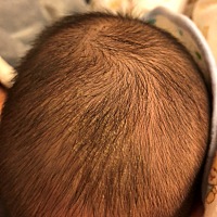 有谁知道孩子的头上是啥东西？