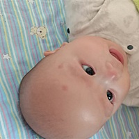 各位宝妈有谁知道这是什么东西吗 是湿疹吗 昨天宝宝脸上起了两个 红色的包包