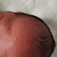 宝宝额头和脸颊都涨了这种小红点点，好担心啊，不知道是什么，有没有其他宝宝也长过