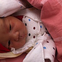 脸上有痘痘怎么这是怎么的