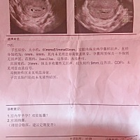 5周左右 去检查医生说是双胞胎 但是太小不确定有知道的宝妈请分享一下