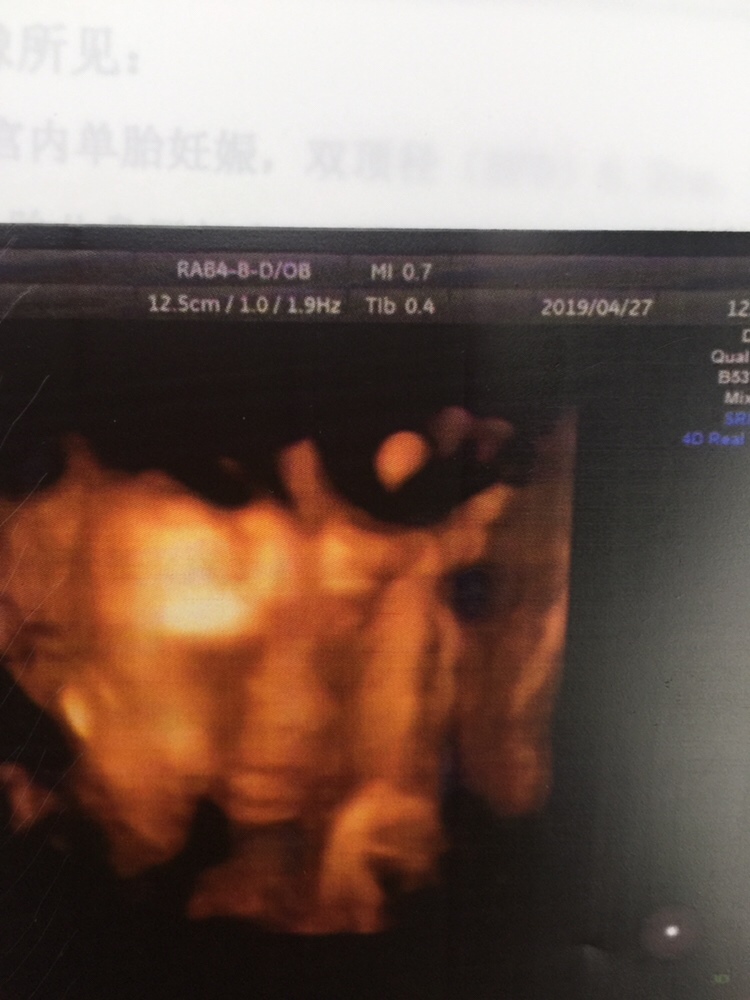 大家看看是男孩还是女孩