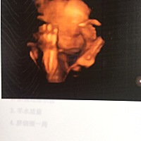 四维回来了 大家看看是男孩还是女孩