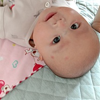 有哪位宝妈知道宝宝脸上这是起的什么吗