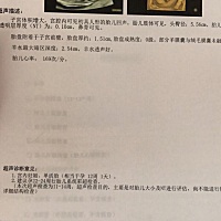 胎心率那么高，正常吗？是女儿吧