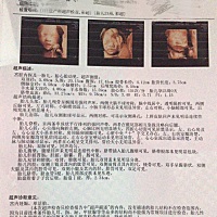 马上卸货了，猜猜男宝女宝，才对奖红包哈，生完报喜😁