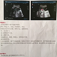 求助各位宝妈有会看男女的吗？
