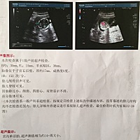 求助各位宝妈有会看男女的吗？谢了