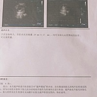 今天去医院做检查，一切正常开心😊