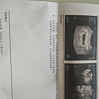 已经六周了，有谁会看男女的吗？下周去化验，但求如意