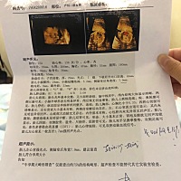 今天22周做了四维，显示胎儿左心室见一强光点，怎么办？第一次有宝宝，没有经验，知道的麻烦指导下，谢...