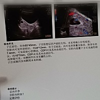 3.16最后一次例假，今天第一次做B超，显示有宫腔积血，开了保胎胶囊和左屈孕酮，能吸收么