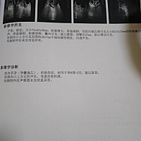 帮我看看男孩女孩