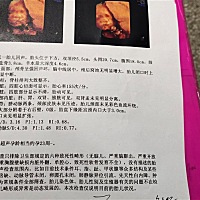 今天做的三维 两次通过  感谢  有会看的宝妈吗  娱乐下 男宝还是女宝