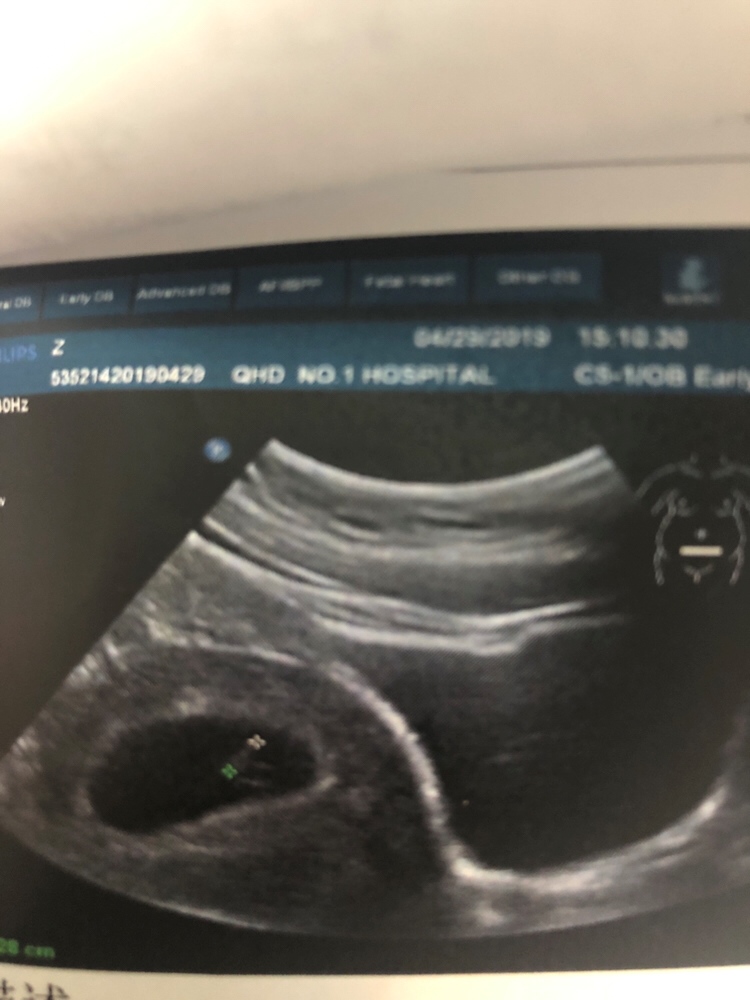 能不能帮我看看是男宝宝还是女宝宝