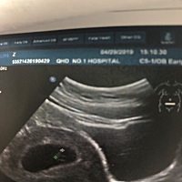 能不能帮我看看是男宝宝还是女宝宝