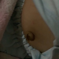 宝宝肚脐这样有没有事啊