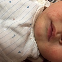 有没有知道这是怎么了，最近宝宝总是流口水，跟这个有关系吗