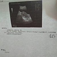 这是52天照的  能看出孕囊是男是女吗