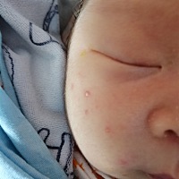 有宝宝长这个吗，宝妈知道这是什么吗