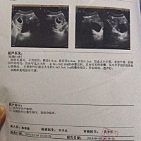 各位大神帮忙看一下，早孕53天， hcg大于50000，孕酮150，有一个囊肿，是不是吃保胎灵和黄体酮吃的？这...