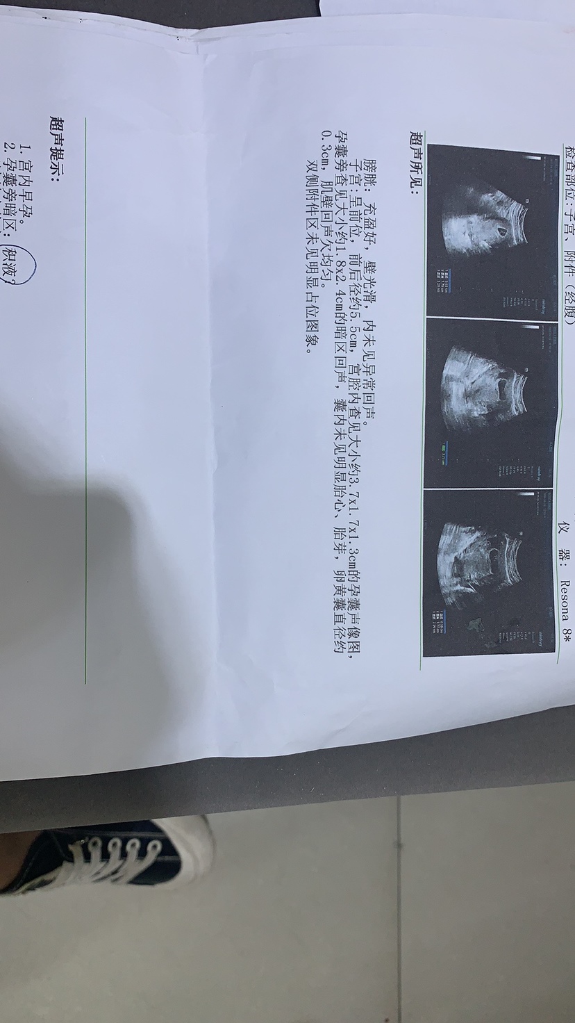 亲们有没有遇到这样的情况