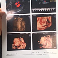 大家帮忙看下男女