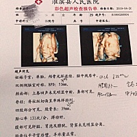 四维顺利通过了……都来帮忙看看男女吧！很好奇是佩奇还是乔治？