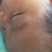 想知道这些疙瘩是什么啊？有没有知道的麻麻！