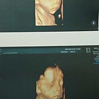 现在35周了，求足月超快顺产🙏🏻🙏🏻🙏🏻