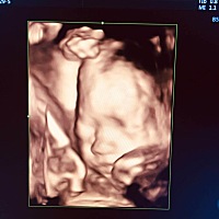 亲们，帮忙看一下是男宝还是女宝？