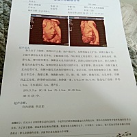 孕23周，前天打四维是男宝，大宝闺女，二宝儿子，儿女双全，感觉二宝好丑啊😄，有没有同款孕期的宝妈