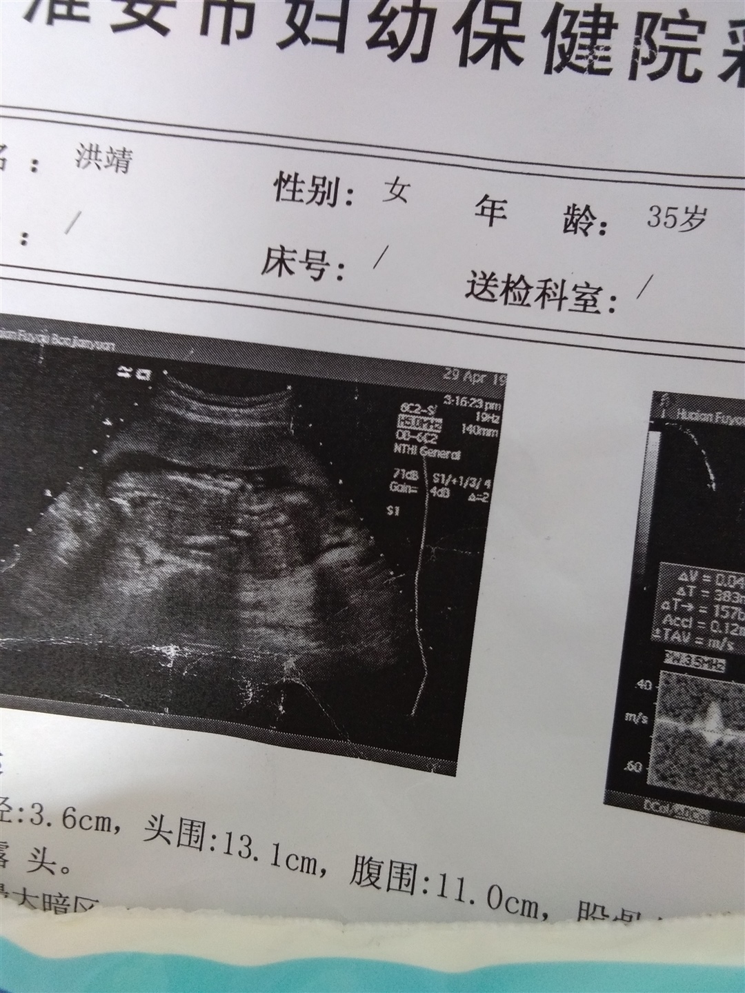 有谁帮我看看是男是女
谢谢啦！