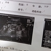 有谁帮我看看是男是女 谢谢啦！