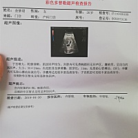 我和我媳妇儿今天下午去医院检查，胚芽只有11mm，而网上查一下8周了应该有20多mm，以后小孩会不会弱小啊...