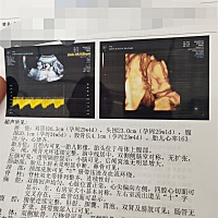 帮我看女孩男孩