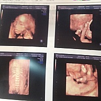 一次性通过，因为只请了两个小时假。没想到二宝这么给力，一开始还紧张的不行怕时间来不及领导一直催，...