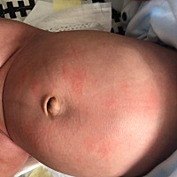 新生儿身上长的这玩意是什么东西啊？宝宝不舒服哭闹，是不是上火了？？？要涂点什么吗