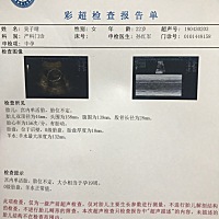 昨天去醫院做了彩超，下午回家肚子鼓起發硬，網上查了是假宮縮。今天覺得肚子發硬，小腹漲得像憋尿。18...