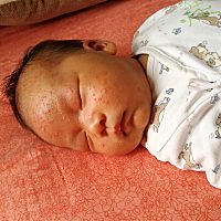 有没有宝妈知道这是怎么了。我女儿以前快满月的时候也这样。