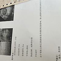 宝妈们有没有会看男宝女宝的？