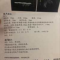 36+4 查了血常规 结果是这样的  这是不是我住在有甲醛屋子的原因？