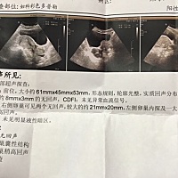 末次月经3.14，4.25验孕棒一深一浅，今天5.1b超检查如图，医生说不确定是否怀孕，又验血待明天下午出报...