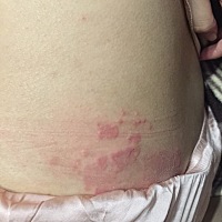 从怀孕一开始就没有早孕反应，除了有点厌食以外，其他都没有，唯一让我头疼的就是从怀孕一开始，背上，...