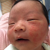 宝宝脸上长满了红颗粒，像是湿疹，这个要怎么办？用什么药好！