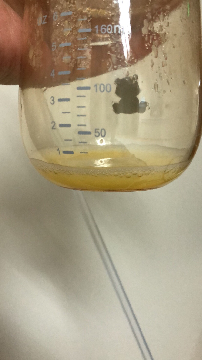 宝贝出生第二天，两边吸出的总量，这个量还是得加奶粉吧，现在基本在医院月嫂都是给喂奶粉，说我的奶不够，孩子吃了奶粉不爱吸奶，好困难所以用吸奶器吸出来给宝贝喝，这个量够他现在的需求吗？有宝马给点意见吗