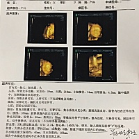 检查前 担心宝宝正不正常 健不健康 检查还顺利 各项指标正常 就是胳膊稍微短了2mm 绕颈一周😊医生检查...
