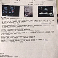 有经验的亲们，帮忙看看是男孩还是女孩……🙏🙏