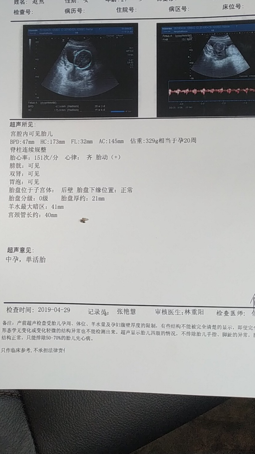 这是男孩还是女孩啊，求帮助